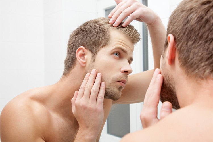 ¿Es la alopecia cosas de hombres?